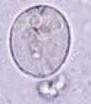 Entamoeba coli1